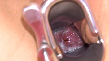 gyno and anal speculum checkup pussy iveta Milf foot leabian